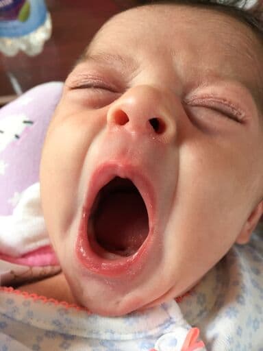 newborn photo with iphone yawning close up